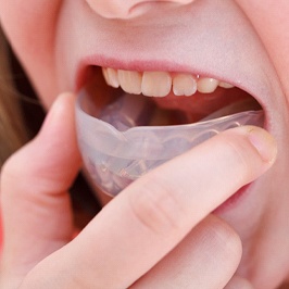 An up-close image of a young child inserting a mouthguard to protect their teeth and gums